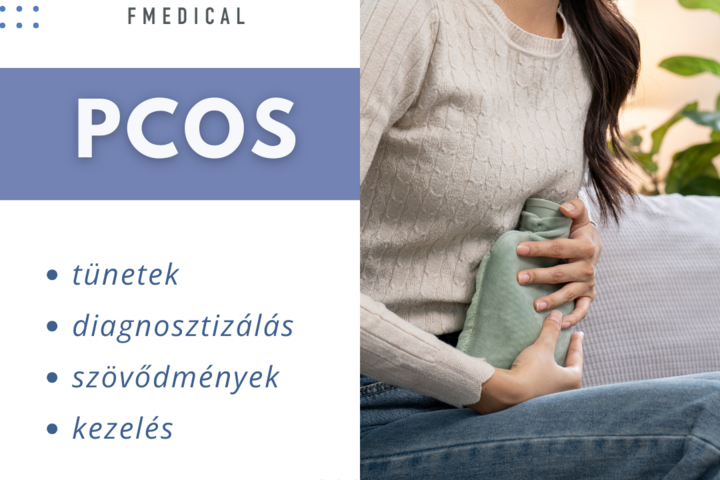 PCOS tünetei és kezelése