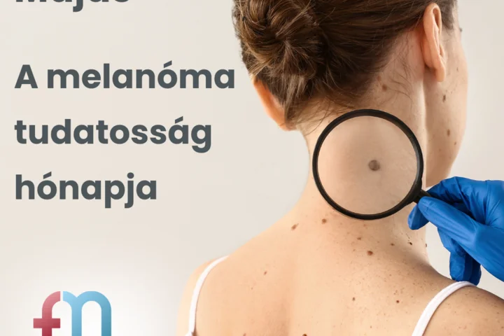 Május a melanóma tudatosság hónapja